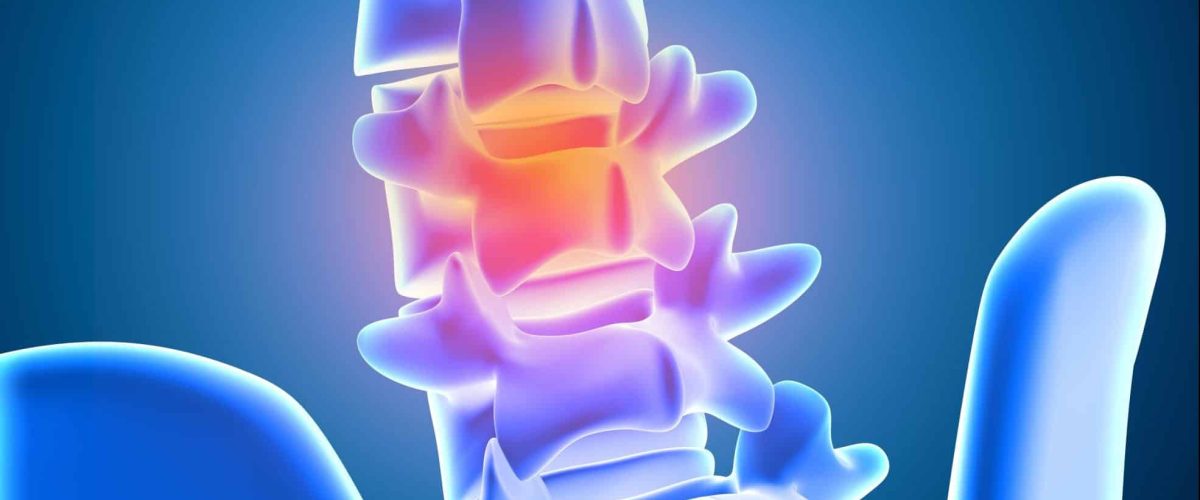 spinal cord injury