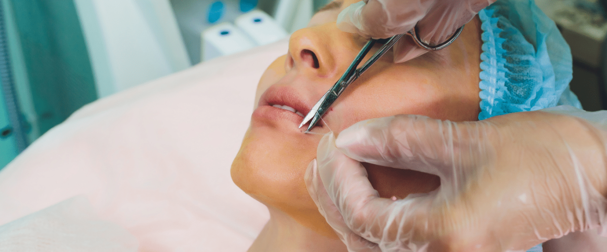 Cosmetic Surgery on Lip